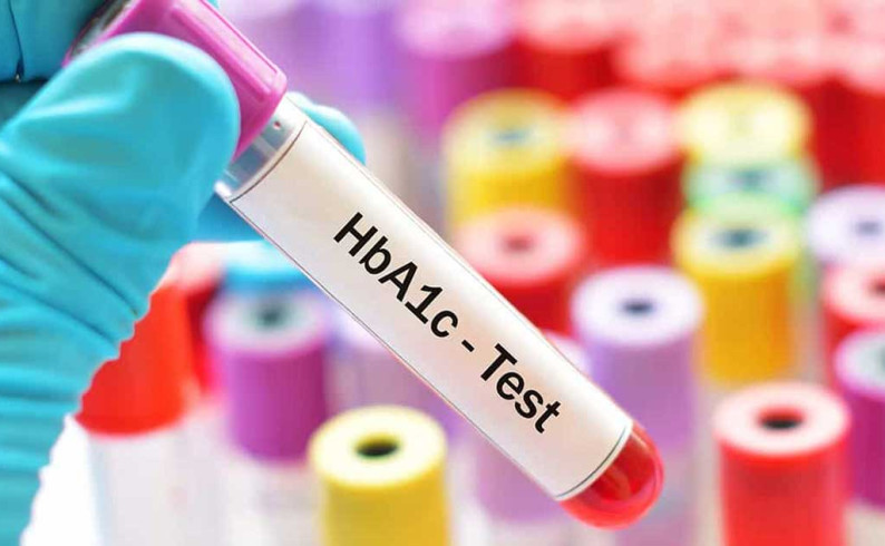 Počinje mjerenje „HbA1c“ glikoliziranog hemoglobina